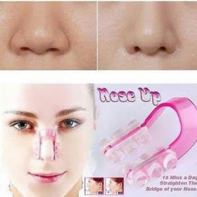 FREE ONGKIR Nose UP / Alat Pemancung Hidung