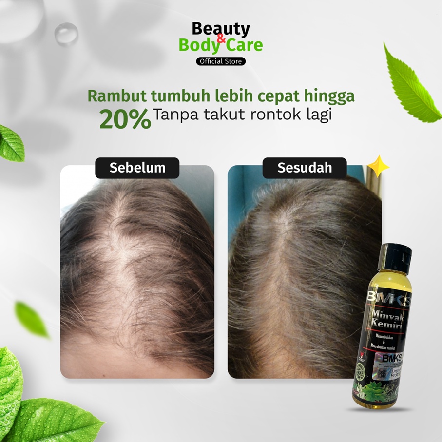 Minyak Kemiri Original 100% Vitamin Penumbuh Perawatan Penyubur Rambut Rontok Botak Parah Cepat Anti Ketombe Untuk Dewasa Pria Wanita Dan Bayi Serum Obat Penebal Penghitam Alis Bulu Mata Jenggot Kumis Rambut Rontok