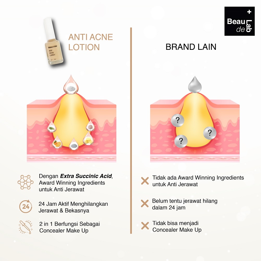 Beaudelab Obat Jerawat | Acne Serum | Acne Concealer | Acne Spot Treatment | Obat totol Jerawat | Penghilang Bekas Jerawat-2