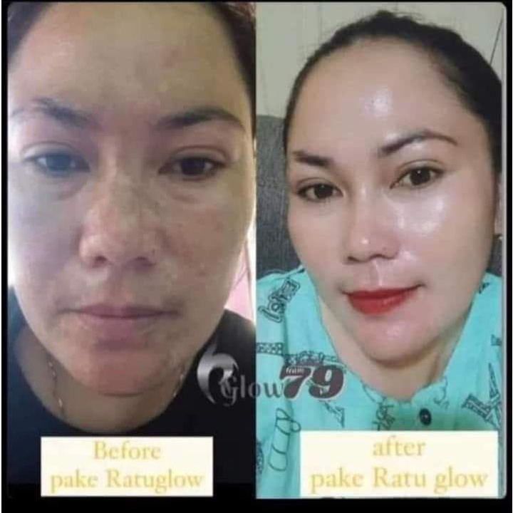 Ratu Glow Skincare BPOM Viral PAKET CREAM WAJAH Glowing series Paket Normal Flek Jerawat bopeng |skincare pelicin wajah-5