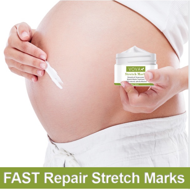 stretch mark cream viva anti wrinkle cream 30ml  Postpartum Repair  remove breast Waist belly Buttocks stretch marks on legs