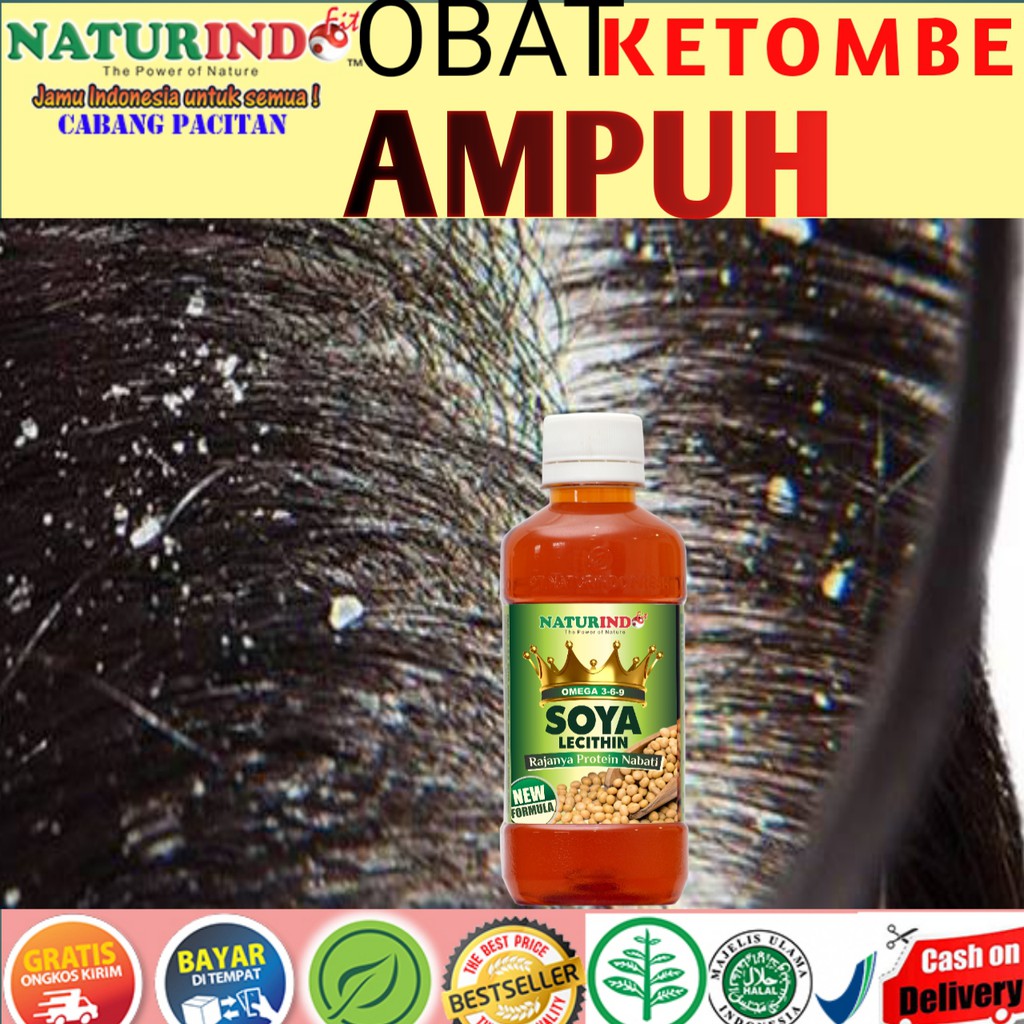 OBAT KETOMBE GATAL BOROKAN KULIT KEPALA BERKERAK PRORIASIS HERBAL KULIT AMPUH BISA COD