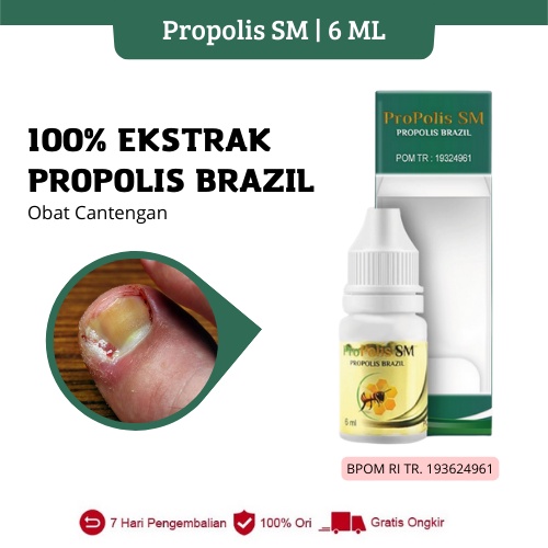 Propolis SM - Obat Cantengan Jempol Kaki Bengkak Dan Bernanah Jamur Kuku Kaki