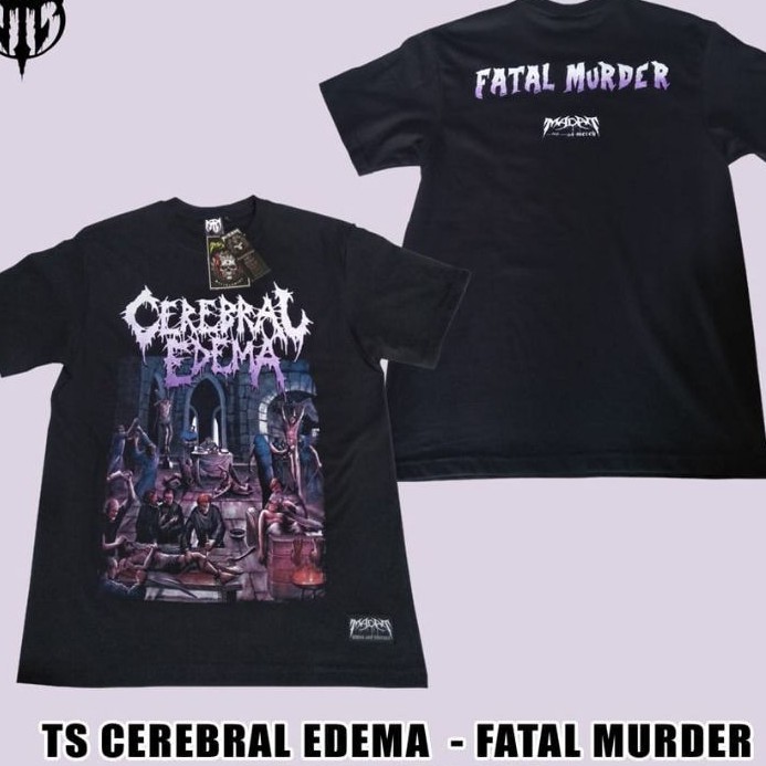 kaos band CEREBRAL EDEMA