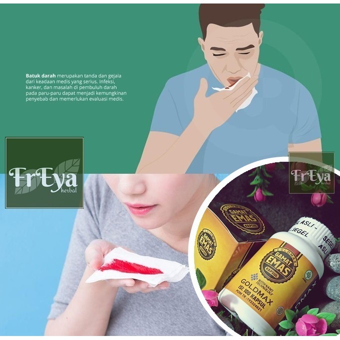 OBAT BATUK BERDARAH, OBAT HERBAL HEMOPTISIS, OBAT BATUK DARAH