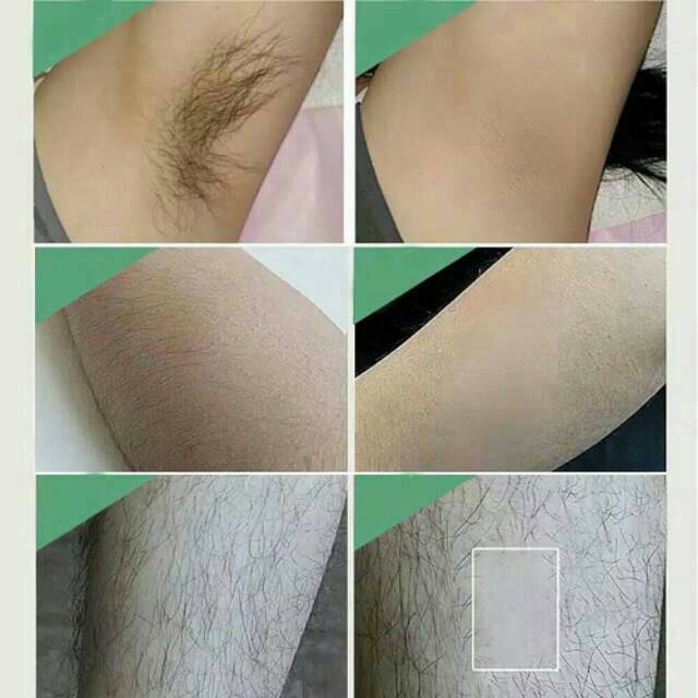 KERTAS WAX/STRIPS WAXING/WAXING STRIPS/PENCABUT BULU KETIAK/WAXING BULU/WAXING KIT/WAX/KERTAS WAXING