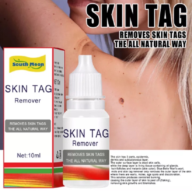 SKIN TAG Obat Penghilang Kutil Tahi Lalat Papiloma