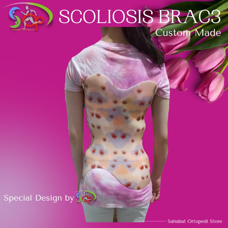 Skoliosis Brace / Scoliosis Brace / MSO Brace