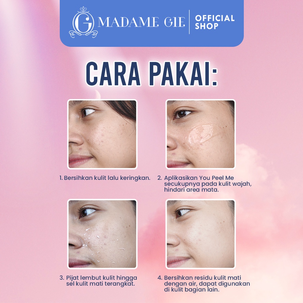 Madame Gie Madame You Peel Me Peeling Gel Mengurangi Kemerahan Pada Kulit