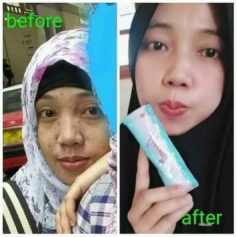 

Amotte minuman colagen