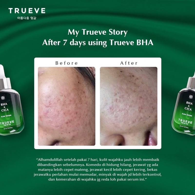 TRUEVE BHA &amp; CICA Acne Serum 30 ML serum wajah