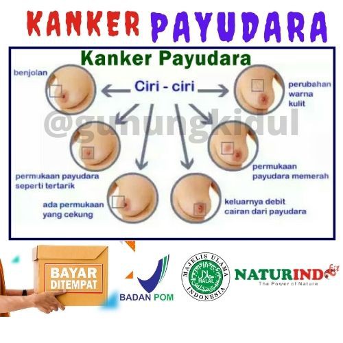 OBAT HERBAL BENJOLAN KANKER TUMOR BISUL JERAWAT BATU LIPOMA UCI UCI HERBAL CARCINOFIT NATURINDO COD-6