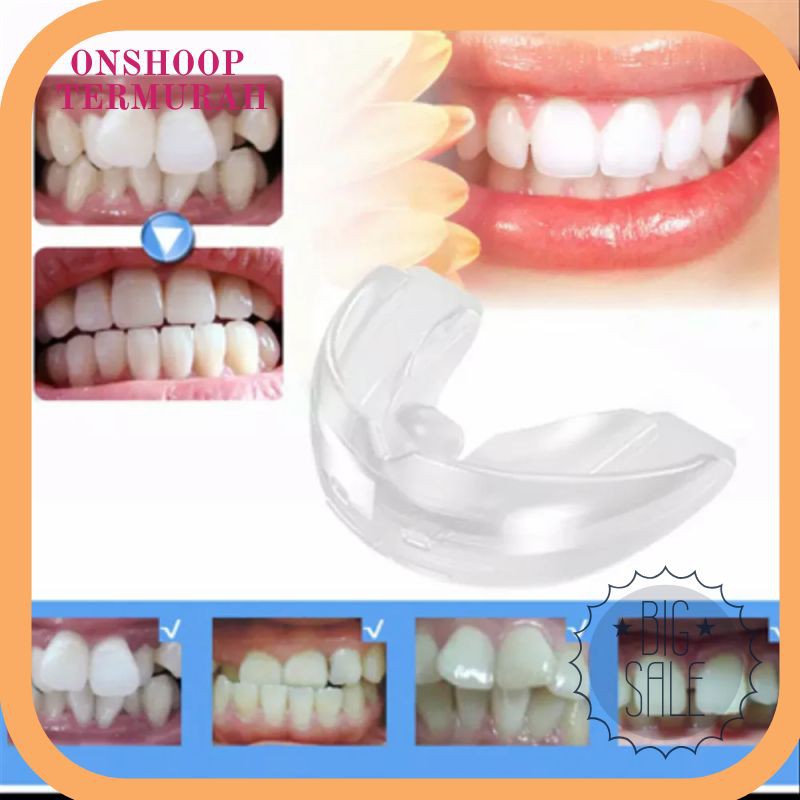 Termurah Teeth Trainer Alignment Orthodontic Retainer - Alat Perapih Gigi Teeth Trainer Terlaris