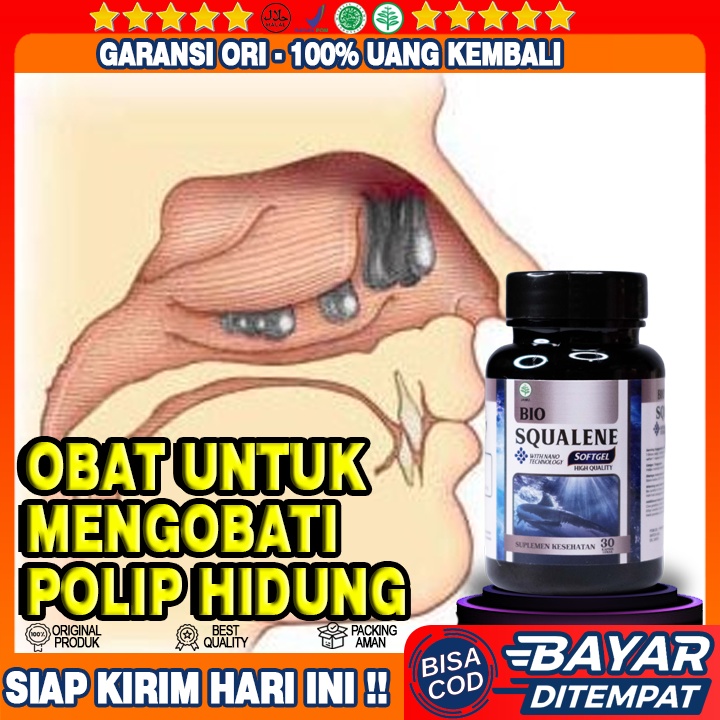 Obat Polip Hidung - Benjolan Di Hidung - Benjolan Di Dalam Hidung - Benjolan Polip - Radang Polip  -