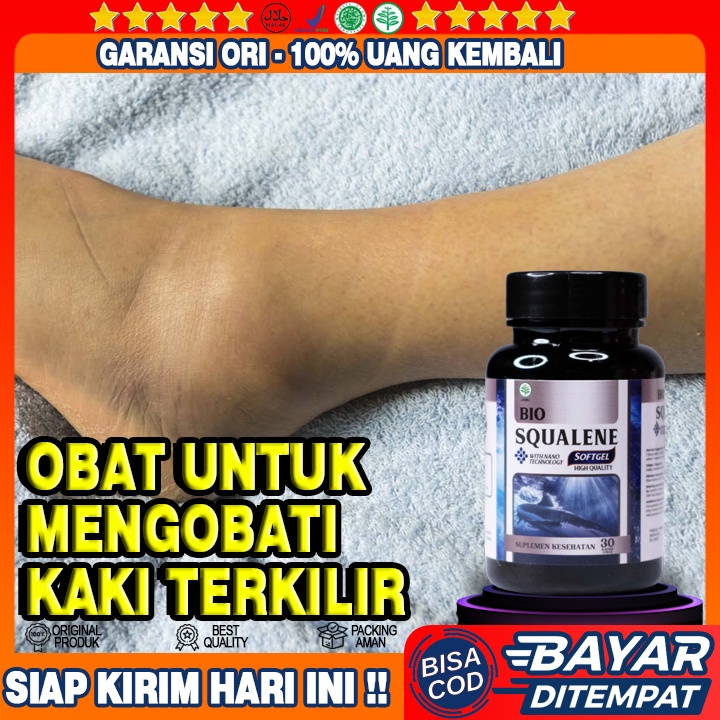 Obat Kaki Terkilir Bengkak - Obat Kaki Terkilir Memar - Obat Kaki Terkilir Kaku - Obat Atasi Kaki Ke