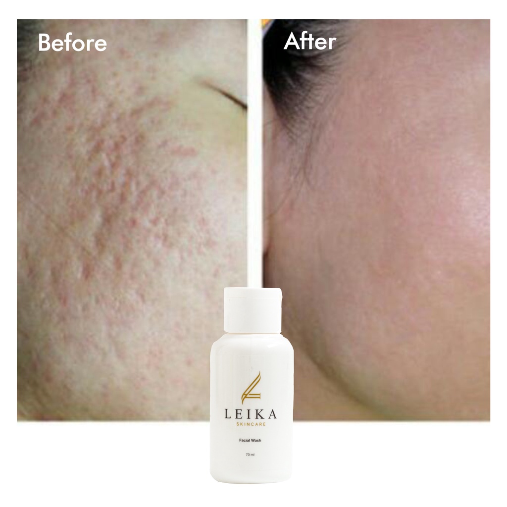 Facial Wash / Sabun Pembersih Pori pori untuk Kulit Wajah Asli 100% Halal Pembersih Wajah Mengecilkan Pori pori Ampuh BPOM Sabun Pengecil Pori pori Facial Wash Leika Skincare - 70ml Resmi BPOM Halal