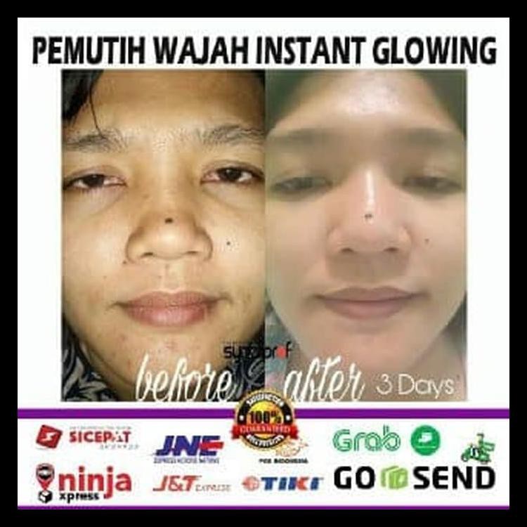 ORIGINAL SKINCARE  PENCERAH DAN PENGENCANG WAJAH | TRULUM SYNERGY