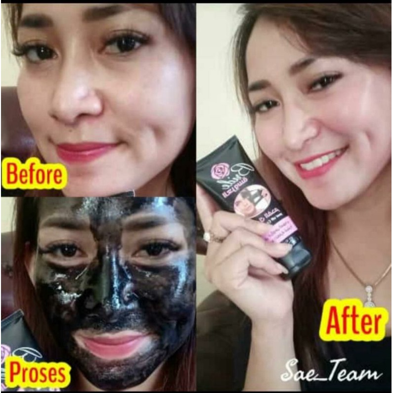 MY WAY masker Charcoal pengangkat komedo dan jerawat original BPOM