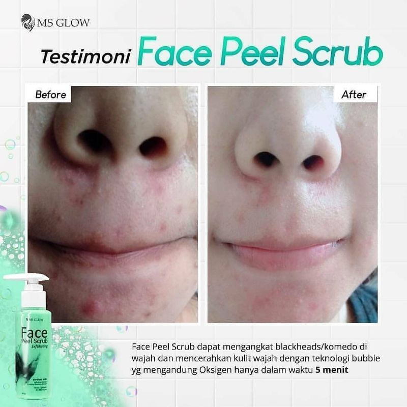 FACE PEEL SCRUB MSGLOW ANGKAT BLACKHEADS KOMEDO EKSFOLIASI