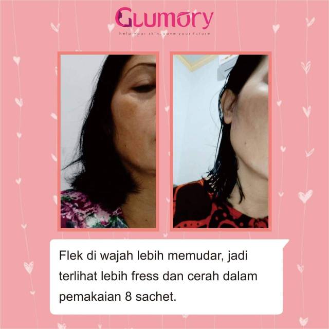 GLUMORY Health &amp; Beauty Solusi Jerawat Kulit Sehat Cerah