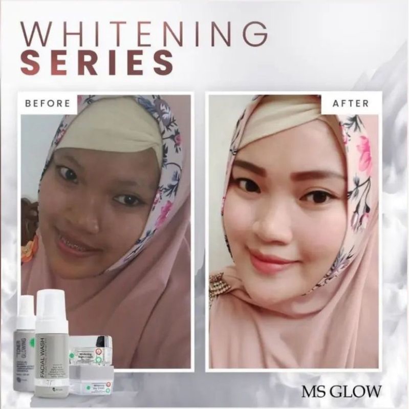 Paket Whitening + Red Jelly Lactobacillus || MS GLOW FREE POUCH