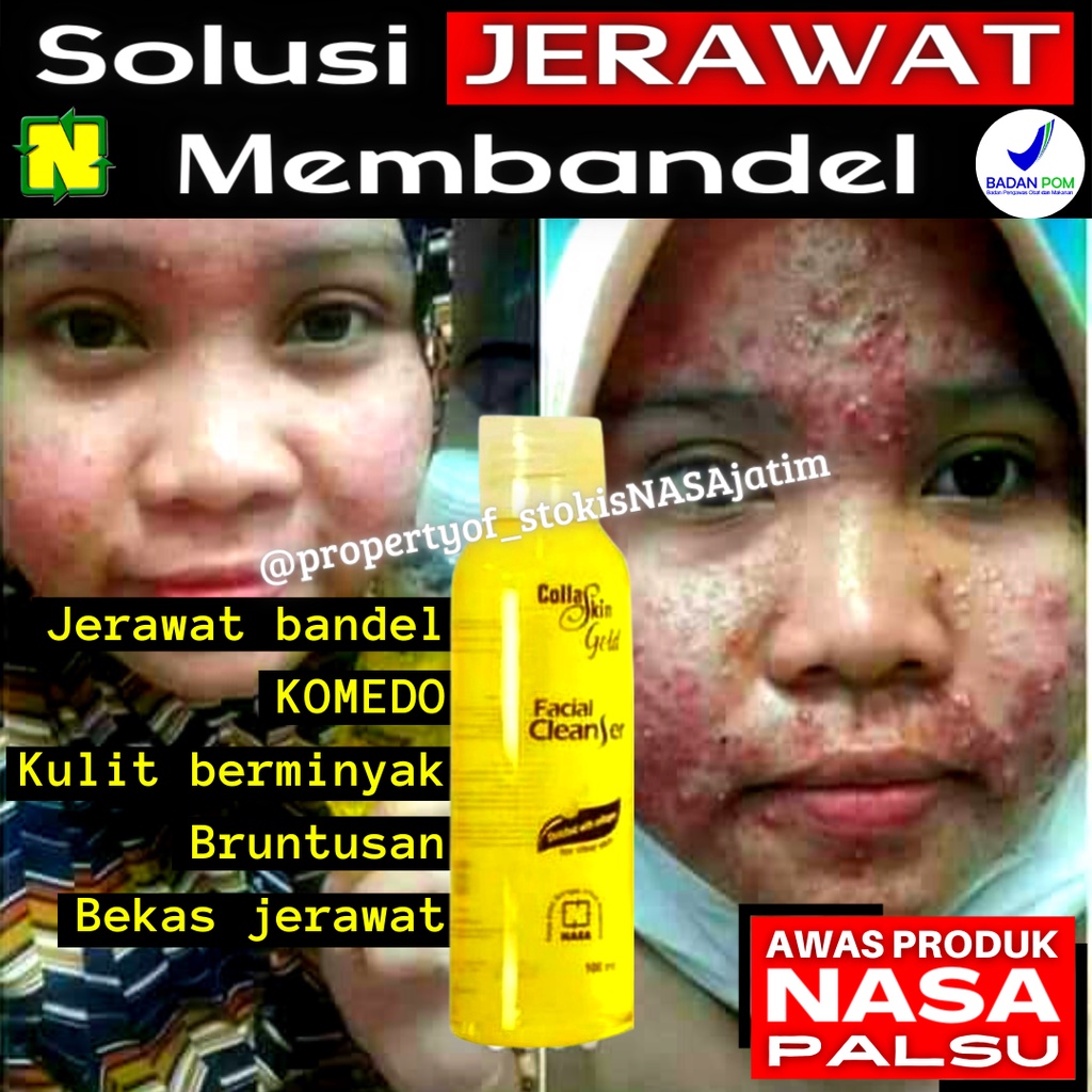 SABUN CAIR PENGHILANG JERAWAT DAN BEKAS JERAWAT BRUNTUSAN AMPUH MENS REACTION ACNO CLEAN OUT LIQUID 