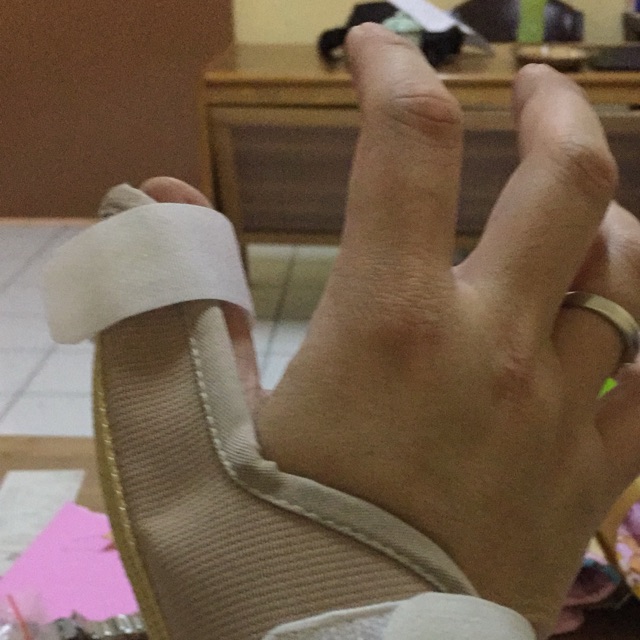 Thumb splint