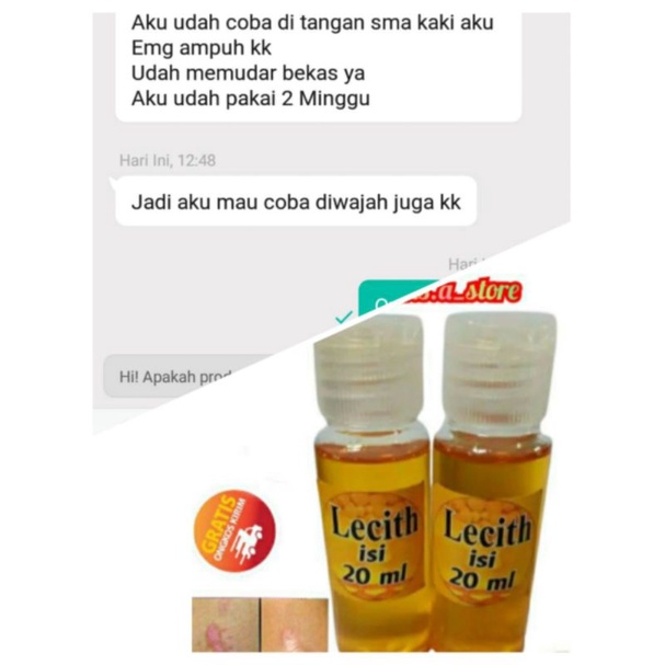 Ecer Lecith 20ml Beli 1 Gratis 1 Obat Flek Hitam/Keloid