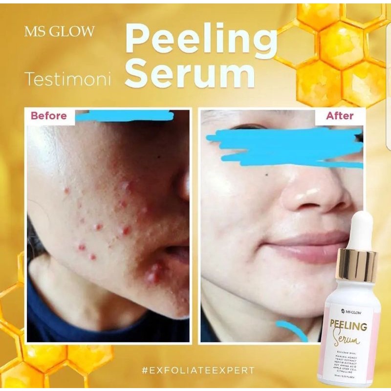 PEELING SERUM 10 ML MS GLOW BARKODE BPOM.