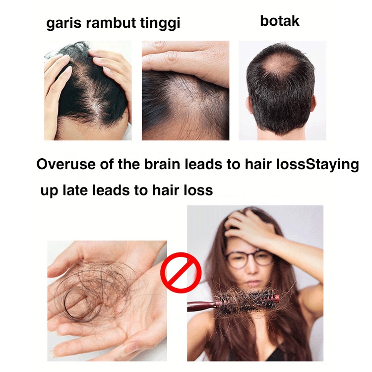 penumbuh rambut penumbuh rambutbotak serum penumbuh rambut 30g serum rambut rontok Penumbuh RambutCepat Anti Rontok Mengatasi Botak