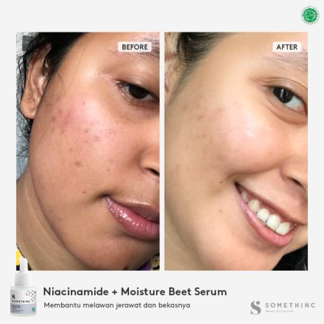 (BISA COD) FACE SERUM ORIGINAL SOMETHINC (HYALURONIC B5 / NIACINAMIDE /PEELING SOLUTION)