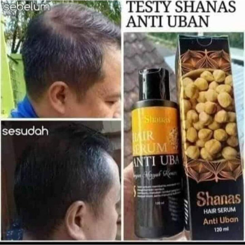 SERUM ANTI UBAN NASA