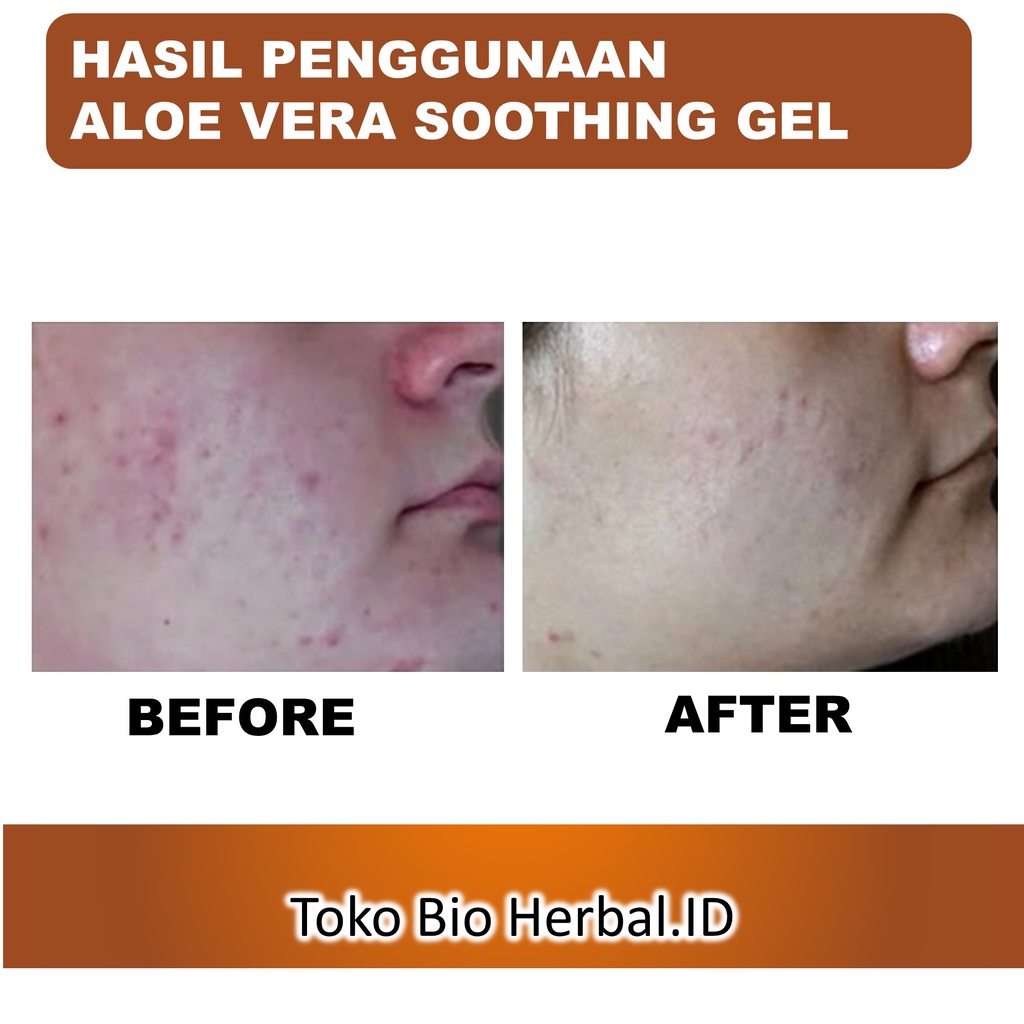 Lidah Buaya Aloe Vera Gel Original Pelembab Wajah Bibir Dan Kulit Kering B7P