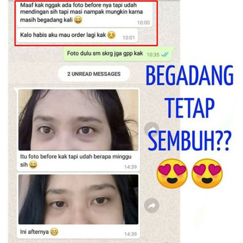 Nebi Ultimate Eye Gel, Cara Mudah Menyamarkan Kantung Mata, Mata Panda &amp; Keriput Untuk Wanita &amp; Pria.