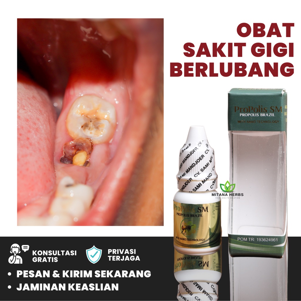 Mitana Herbal - Obat Sakit Gigi Berlubang - Obat Gigi Ngilu - Obat Gigi Kuning - Obat Gigi Goyang - 