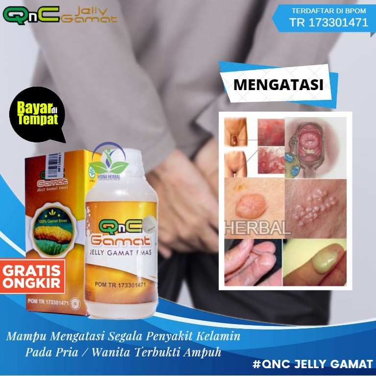 Obat Varikokel Varicocele Herbal 100 Asli Obat Hidrokel Testis Buah Zakar Bengkak Qnc Shopee Indonesia