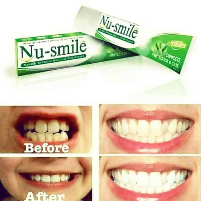 Nu-Smile