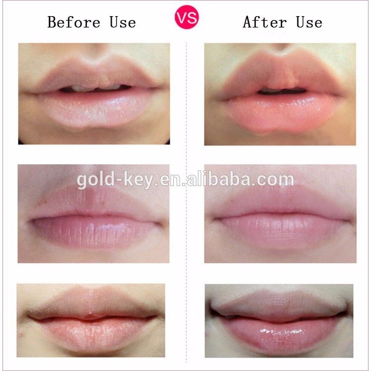 [25pcs] Masker Bibir Emas 24K untuk Memerahkan Melembabkan Bibir dan Menyembuhkan Bibir Pecah