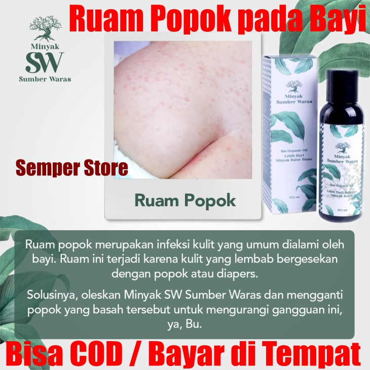 Jual Cara Mengobati Ruam Popok Pada Bayi Laki-Laki & Perempuan Aman Ampuh Pakai Minyak Balur Sw Bpom Asli Indonesia|Shopee Indonesia