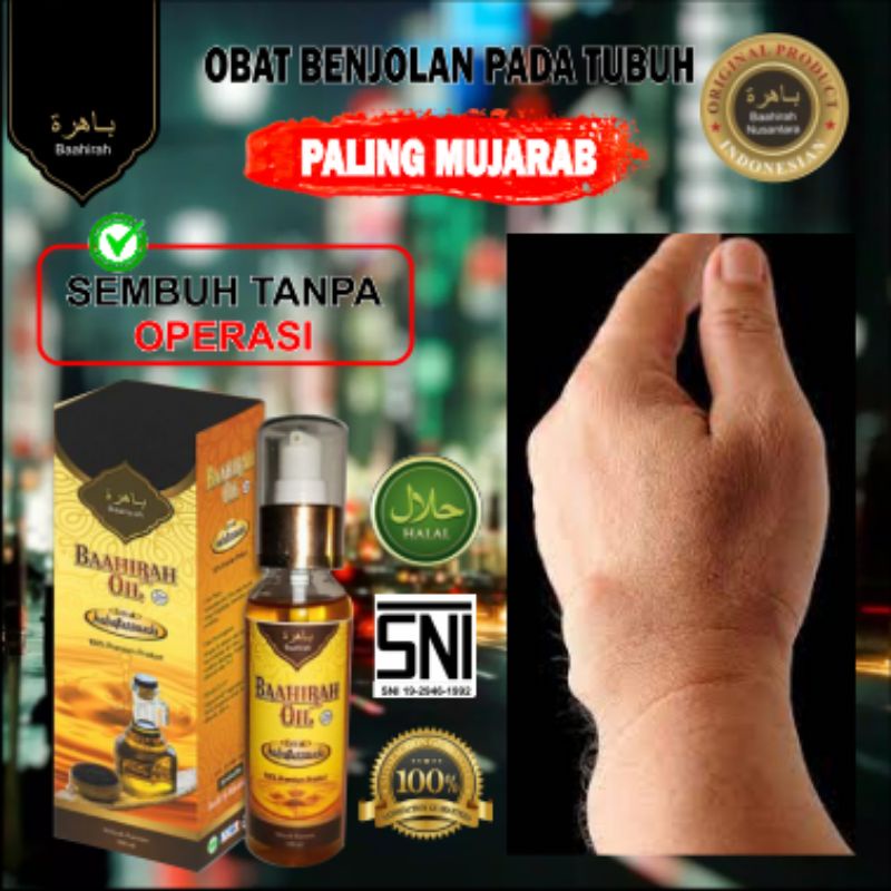 MINYAK OLES BAAHIRAH OIL- Obat oles benjolan, Ganglion, Lipoma dll