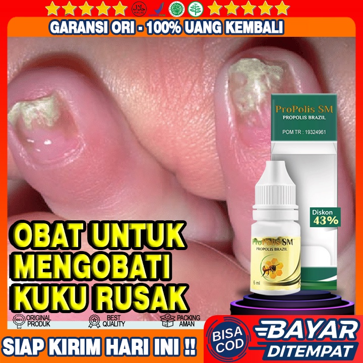 Jual Obat Kuku Rusak Kuku Cantengan Jamur Pada Kuku Kuku Membusuk