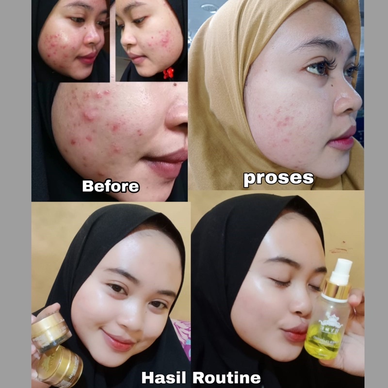 Hyde Beauty Skincare Paket Glowing Isi 3