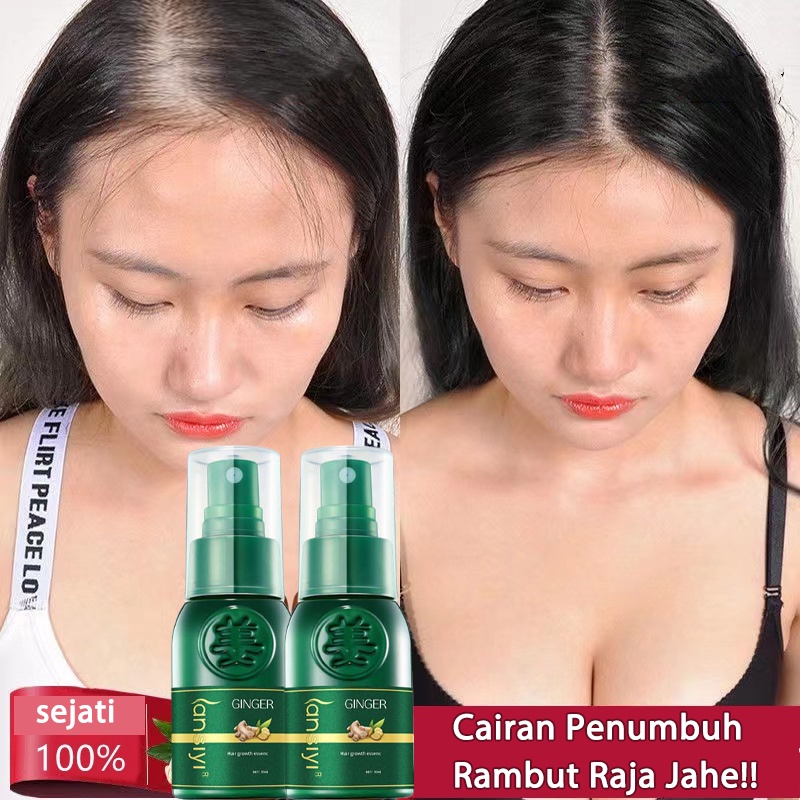 penumbuh rambut serum 30ml hair care Cepat dan efektif anti kebotakan/pertumbuhan rambut/perawatan kulit kepala/penebalan rambut