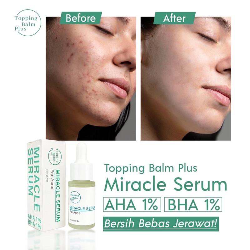 MIRACLE SERUM  AHA BHA FOR ACNE / SERUM AJAIB UNTUK JERAWAT /  SERUM ANTI ACNE BPOM