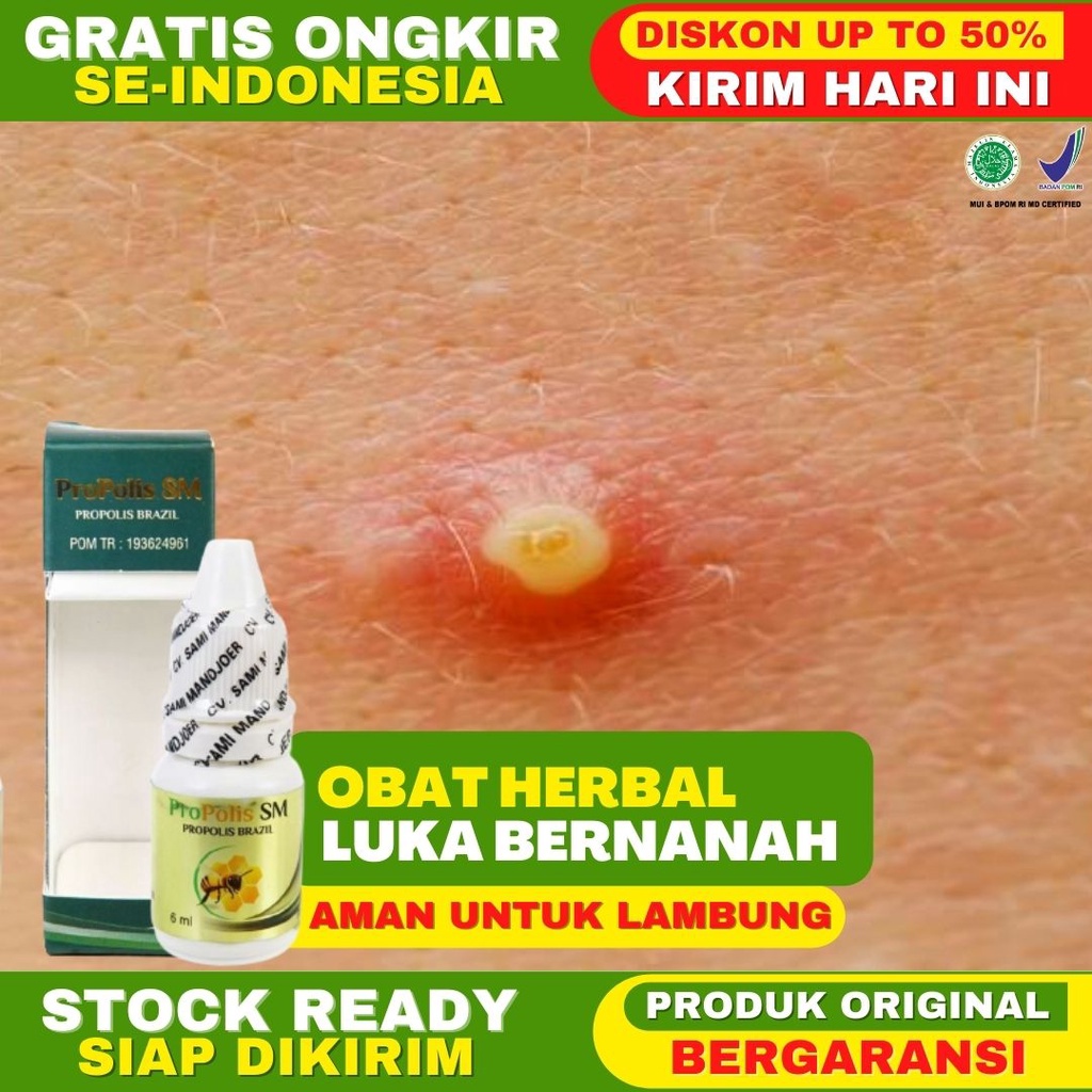 OBAT LUKA BERNANAH Obat Bisul Bernanah Obat Infeksi Bisul Infeksi Luka Bernanah Propolis SM BPOM