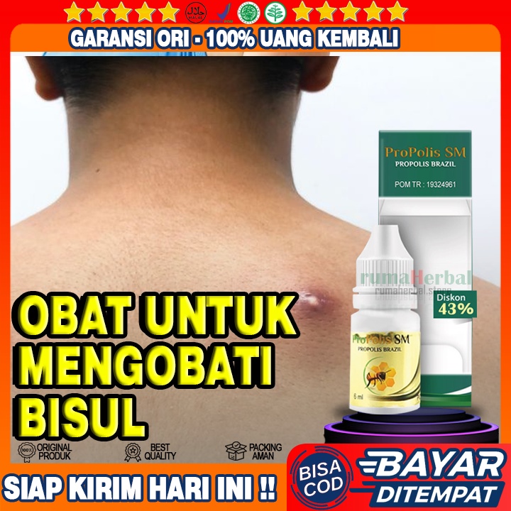 Obat Bisul, Obat Bisul Parah, Obat Bisul Bengkak, Obat Bisul Besar, Obat Bisul di kemaluan, Obat ben