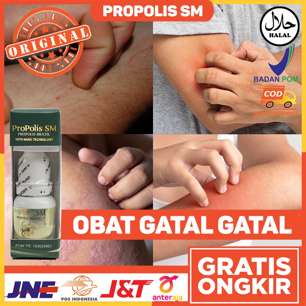 Obat Alami Gatal Gatal - Obat Kulit Gatal - Obat Gatal di Selangkangan - Obat Infeksi Kulit - Obat B