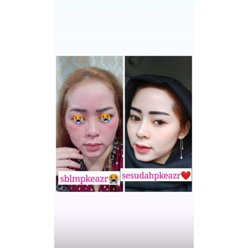 CREAM AZR BEAUTY AZR BEAUTY AZR PAKET KECANTIKAN