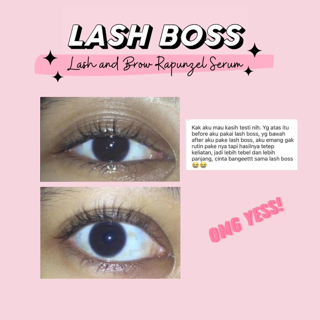 ✨Up Your Look✨ Lash Boss lashboss Lash and brow magic serum, serum bulu mata dan alis