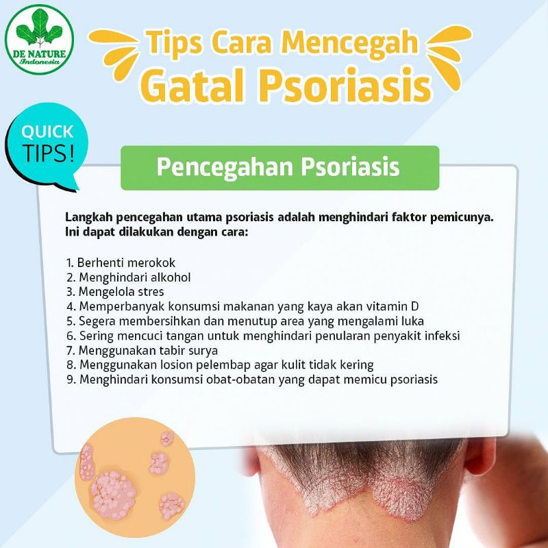 EXIMTAS EXCLEAR Obat Gatal Selangkangan Obat Kulit Gatal Jamur Bentol Merah Bersisik Obat Eksim Gatel Alergi Kurap Salep Gatal Menahun Alergi Kulit Scabies  Salep Kudis Obat Loang Obat Untuk Atasi Gatal Di Leher di Lengan Bintik Bintik Merah Asli DeNature-4